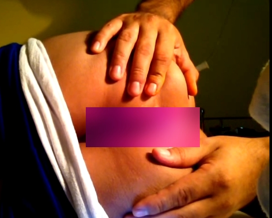 手指按摩器：ChaGang医务室专用